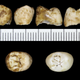 Multiple views of a molar belonging to the skull.